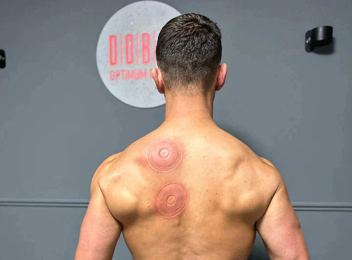 SmartCup: Professional Red Light Cupping Therapy Massager