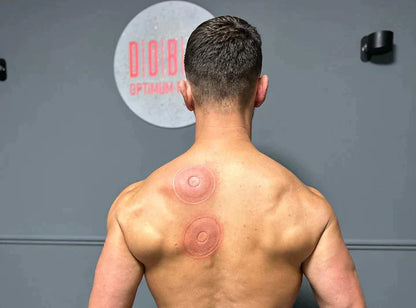 SmartCup: Professional Red Light Cupping Therapy Massager