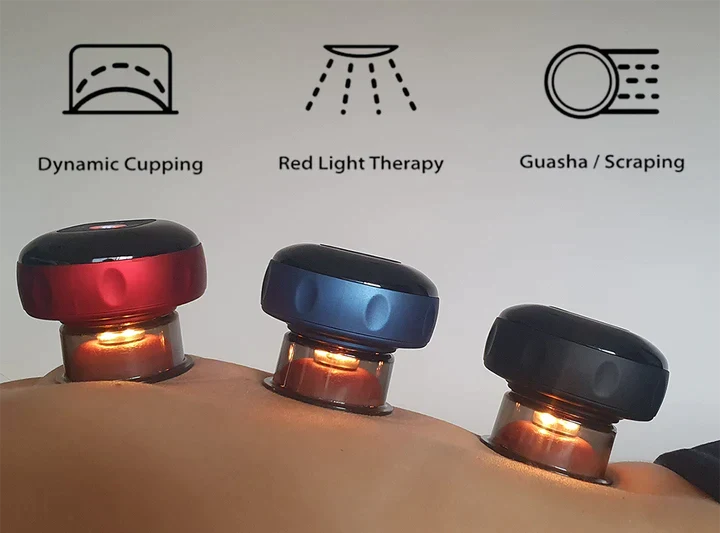 SmartCup: Professional Red Light Cupping Therapy Massager