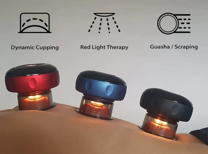 SmartCup: Professional Red Light Cupping Therapy Massager